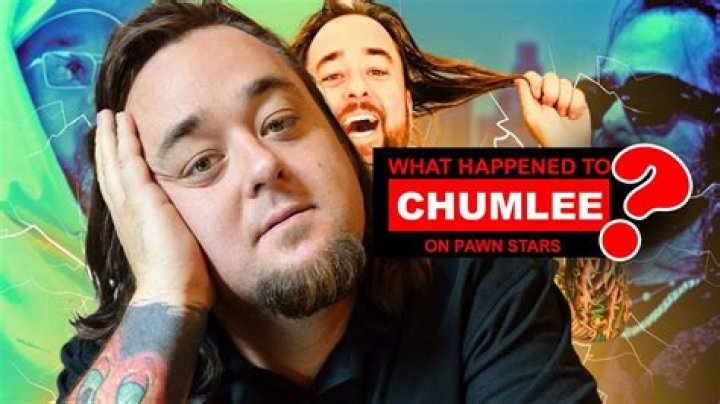 Does Chumlee On Pawn Stars Have False Teeth?