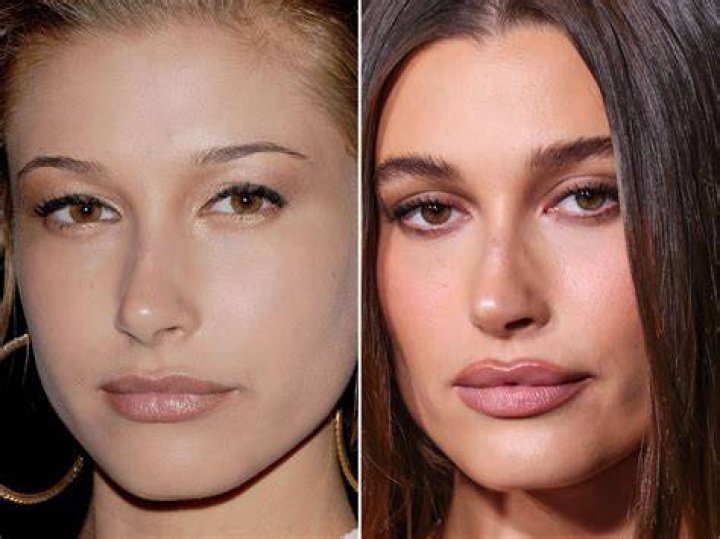 
Hailey Bieber: Before And After 