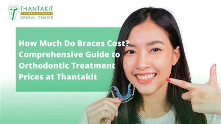 How much does western dental charge for braces